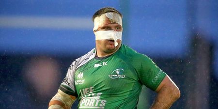 Pics: Nathan White got his face badly busted up playing an Interprovincial A match today