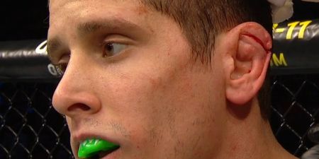 WATCH: Bizarre ear injury leads to first round stoppage of Brandao v Hettes