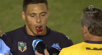 Video: Rugby player suspended after breaking opponent’s jaw with a knee to the face