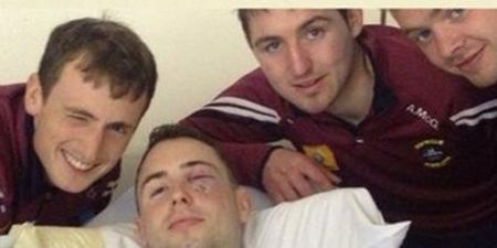 PIC: Westmeath hurler tweets the gruesome result of a sliothar to the face