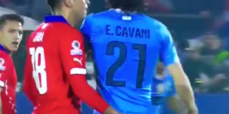Edinson Cavani was sent off for slapping the man who gave him a prostate exam