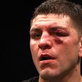 UFC superstar Nick Diaz to serve the Jon Jones rehab stint of jail sentences after DUI charge