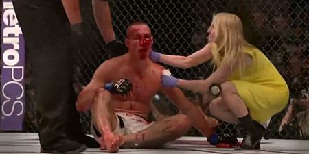 X-Ray: Rory MacDonald’s nose is completely obliterated after epic war with Robbie Lawler