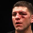 UFC notified of potential Anti-Doping Policy violation involving Nick Diaz