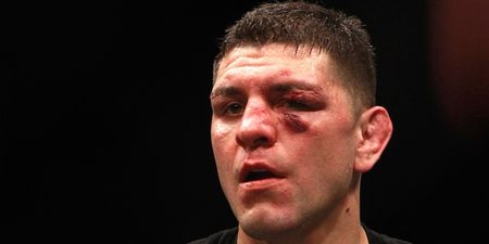 UFC notified of potential Anti-Doping Policy violation involving Nick Diaz