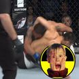 VIDEO: UFC Seoul fight stopped following gruesome dislocated elbow