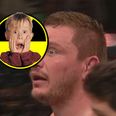 GRAPHIC: UFC star Matt Mitrione suffers gruesome, genuinely stomach-churning eye injury