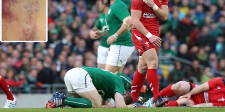 PIC: Brian O’Driscoll shows what happens to your arse when Scott Williams hits you at 27 Gs