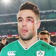 Conor Murray speaks eloquently about the eye injury that almost cost a friend his rugby career