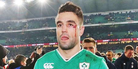 Conor Murray speaks eloquently about the eye injury that almost cost a friend his rugby career