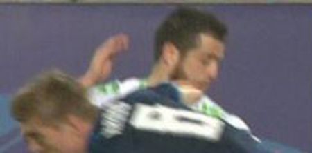 WATCH: Wolfsburg’s Vieirinha spits out tooth after eating elbow from Toni Kroos