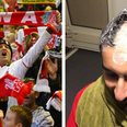 This Liverpool fan had to shave his head after saying they wouldn’t beat Borussia Dortmund