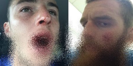 GRAPHIC: When professional rugby players’ heads clash, lips stand no chance whatsover