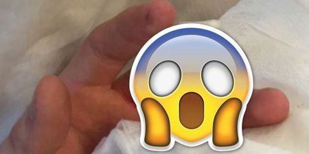 GRAPHIC: Carlow club footballer suffers the most gruesome finger injury imaginable