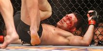 Former UFC champ’s scary concussion story raises some serious questions