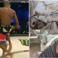 Michael Page describes the moment he landed the skull-fracturing knee on ‘Cyborg’ Santos