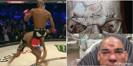 Michael Page describes the moment he landed the skull-fracturing knee on ‘Cyborg’ Santos