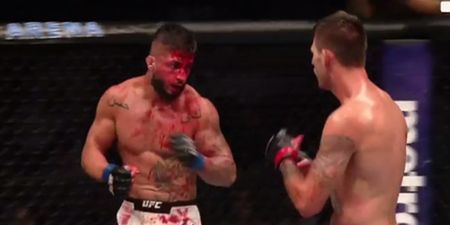 “Bloody mess” doesn’t begin to express the state of Sabah Homasi after Tim Means’ mauling