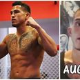 PICS: Anthony Pettis looking a shadow of himself ahead of UFC featherweight debut
