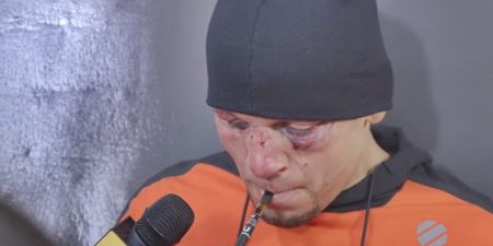 Wednesday was definitely a good news, bad news day for Nate Diaz