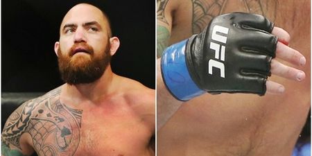 PICS: Travis Browne’s finger looks even worse than when he broke it at UFC 203 [GRAPHIC]