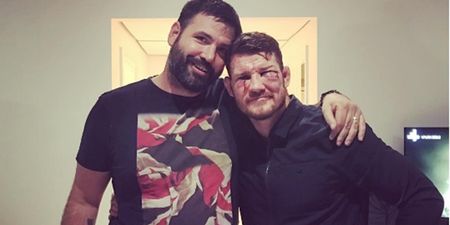 Michael Bisping’s face was in an awful way the day after his UFC 204 triumph over Dan Henderson