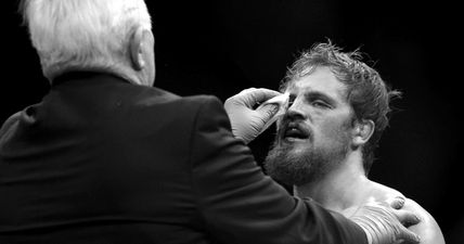 UFC Belfast loses main event as SBG’s Gunnar Nelson suffers injury