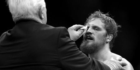 UFC Belfast loses main event as SBG’s Gunnar Nelson suffers injury