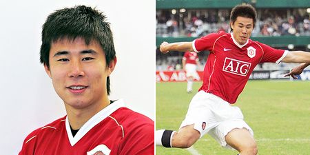 Manchester United legend Dong Fangzhuo undergoes plastic surgery to escape constant mockery