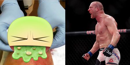 GRAPHIC: UFC star Pat Cummins out of Albany with absolutely hideous injury