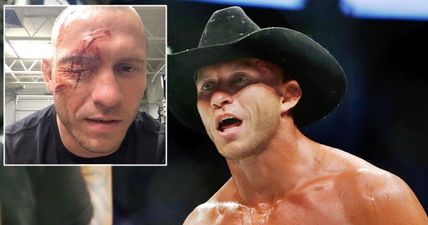 WATCH: Donald Cerrone on what really happened with that nasty eye injury