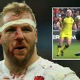 WATCH: Real concern for England as James Haskell’s rhino tackle sees him off with nasty head injury