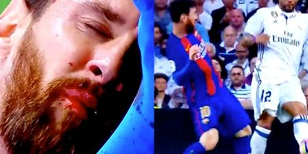 WATCH: Lionel Messi is left dripping with blood after Marcelo challenge