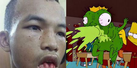 Muay Thai fighter suffers the worst split lip you’re ever likely to see