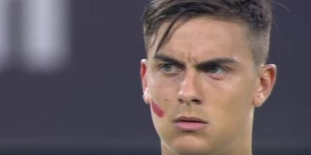 Napoli and Juventus players wear red paint on faces for beautiful cause