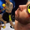 British MMA veteran suffers the most gruesome cut you’ll ever see