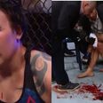 UFC fighter’s corner deservedly slammed for shockingly neglectful treatment