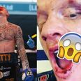 Boxer reveals the extent of horrific mouth injury suffered during fight