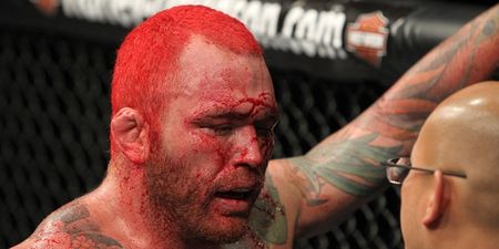 UFC veteran accepts bare-knuckle boxing fight two years after serious heart condition forced him into retirement