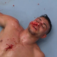 One-armed fighter Nick Newell cuts a dejected figure as UFC dream slips away