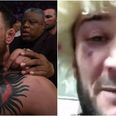 Khabib’s cousin shares images of damage Conor McGregor inflicted