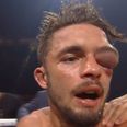 Anthony Yigit suffers brutal eye injury in defeat to Ivan Baranchyk