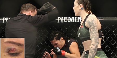 Cat Zingano shows off nasty effects of toe to her eye