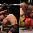Mike Perry suffers horrific nose break after ‘Fight of the Night’ war