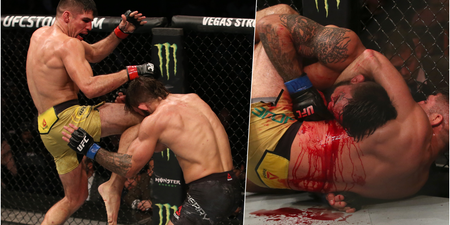 Mike Perry suffers horrific nose break after ‘Fight of the Night’ war