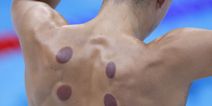 What are the dark circles on swimmers backs at Tokyo Olympics?