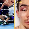“It is what it is” – Michael Conlan shares uplifting update from hospital bed after sickening knock-out
