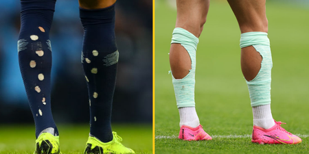 The reason footballers cut holes in their socks before matches